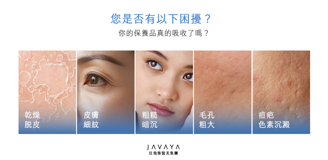 水光注射/水光槍-哪些人適合做水光注射? 1.乾燥肌 2.有細紋 3.皮膚暗沉 4.毛孔粗大 5.痘疤色素沉澱 | 佳飛雅醫美